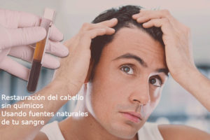 Alopecia - Prdida de pelo