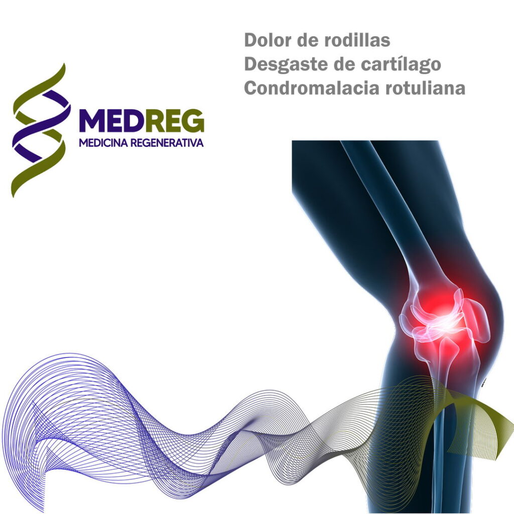 Dolor de rodilla