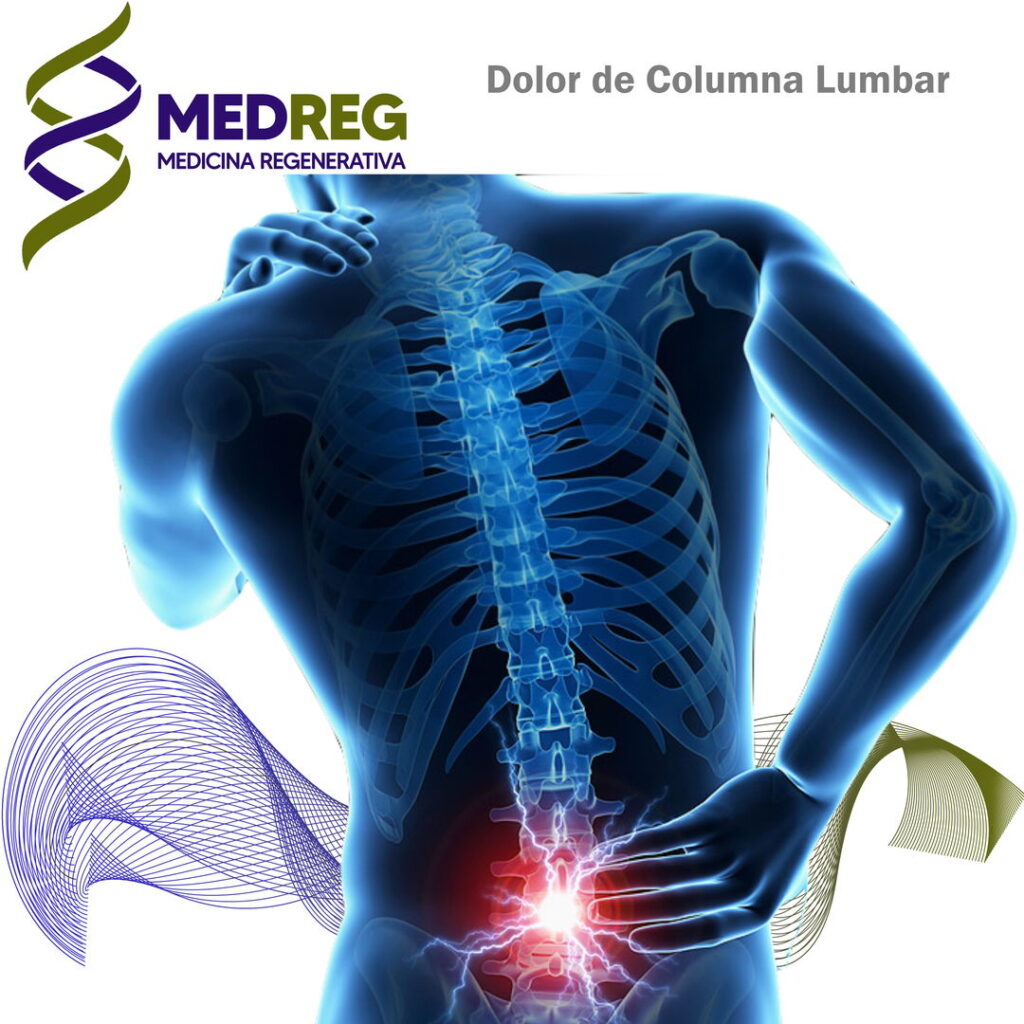 Dolor lumbar