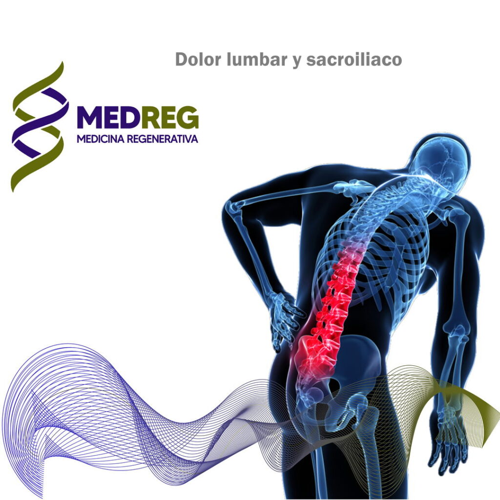 Dolor lumbar y sacroiliaco